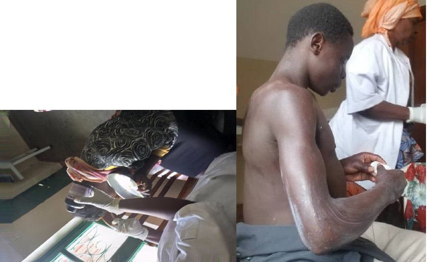 Assistances médicales des enfants Orphelins — prévention des maladies cutanées, Bukavu